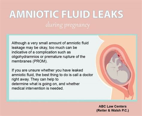 leakage of amniotic fluid|Signs Of Leaking Amniotic Fluid Vs. Discharge: The Difference